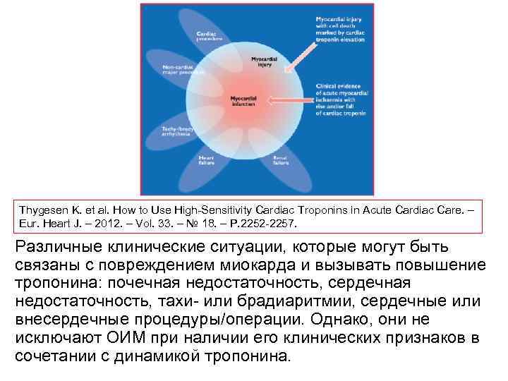 Thygesen K. et al. How to Use High Sensitivity Cardiac Troponins in Acute Cardiac