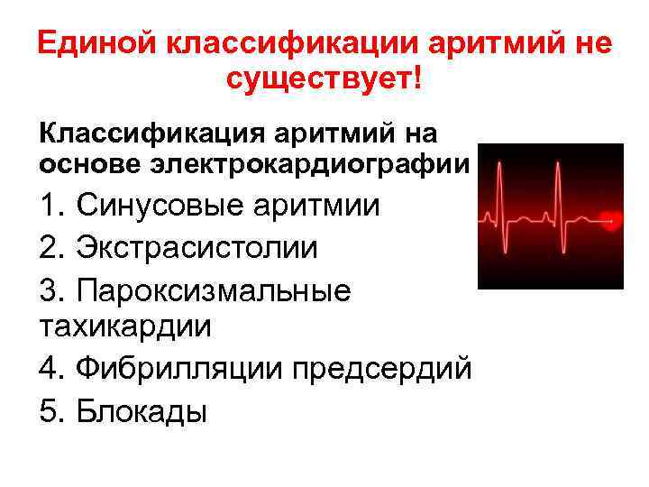 Единой классификации аритмий не существует! Классификация аритмий на основе электрокардиографии 1. Синусовые аритмии 2.