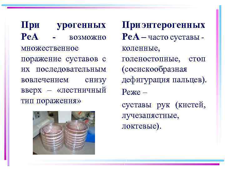 При Ре. А урогенных возможно множественное поражение суставов с их последовательным вовлечением снизу вверх