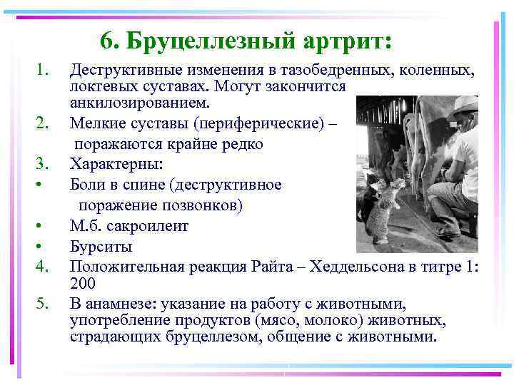 6. Бруцеллезный артрит: 1. 2. 3. • • • 4. 5. Деструктивные изменения в