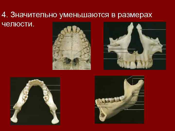 4. Значительно уменьшаются в размерах челюсти. 