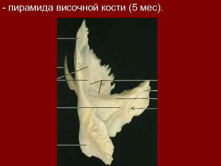 - пирамида височной кости (5 мес). 
