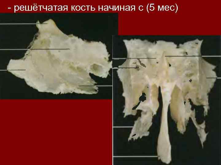 - решётчатая кость начиная с (5 мес) 
