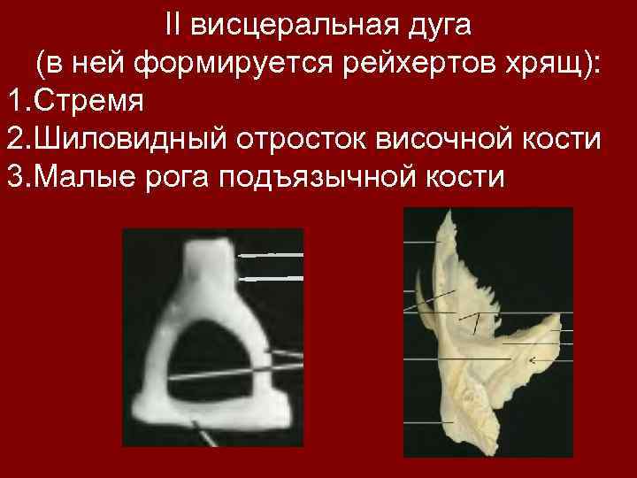 II висцеральная дуга (в ней формируется рейхертов хрящ): 1. Стремя 2. Шиловидный отросток височной