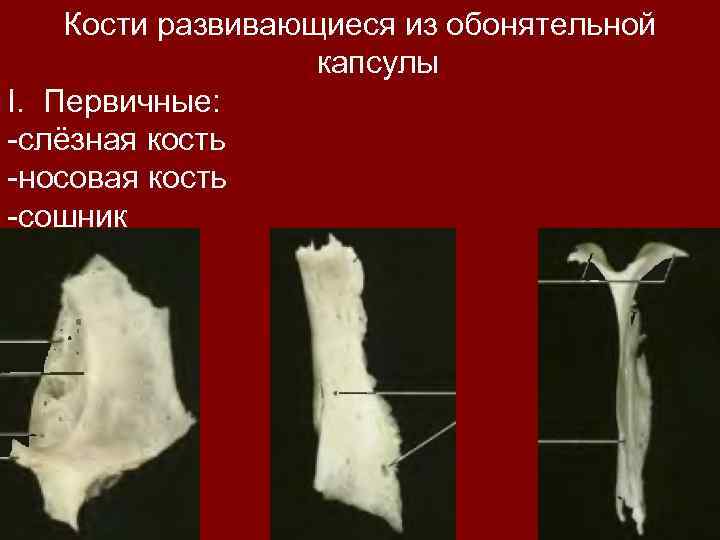 Кости развивающиеся из обонятельной капсулы I. Первичные: -слёзная кость -носовая кость -сошник 