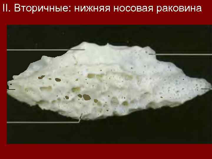 II. Вторичные: нижняя носовая раковина 