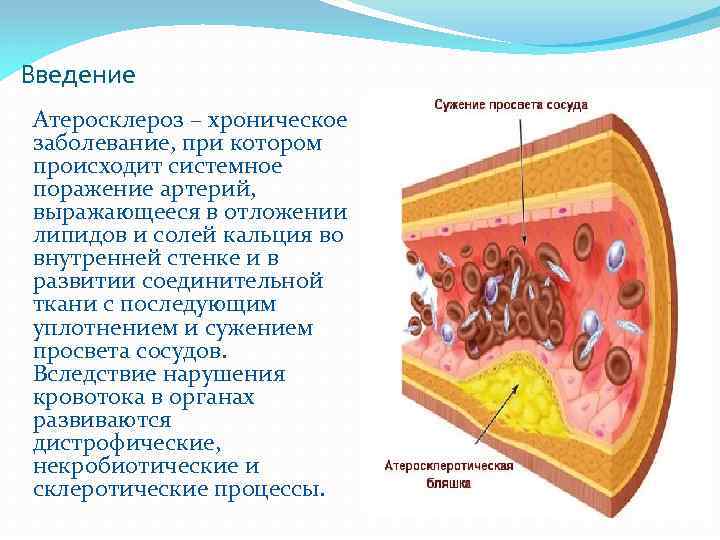 Введение Атеросклероз – хроническое заболевание, при котором происходит системное поражение артерий, выражающееся в отложении