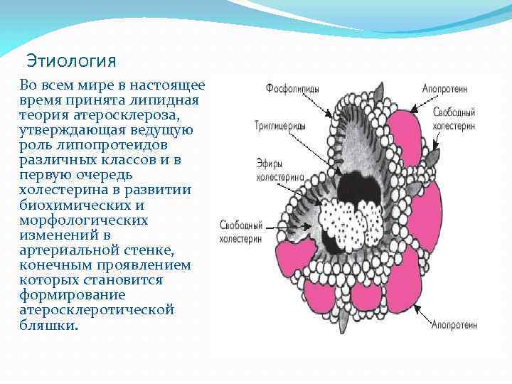 Этиология Во всем мире в настоящее время принята липидная теория атеросклероза, утверждающая ведущую роль