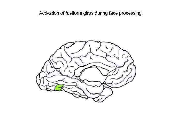 Activation of fusiform girus during face processing 