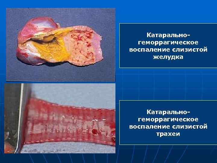 Катаральногеморрагическое воспаление слизистой желудка Катаральногеморрагическое воспаление слизистой трахеи 