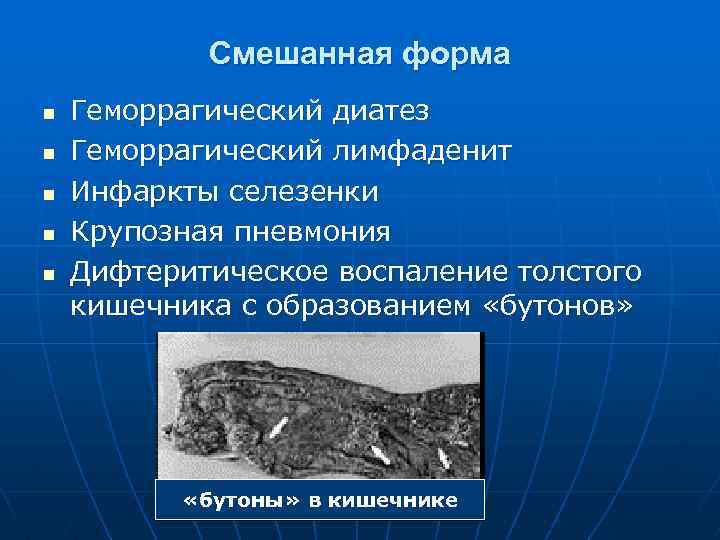 Смешанная форма n n n Геморрагический диатез Геморрагический лимфаденит Инфаркты селезенки Крупозная пневмония Дифтеритическое