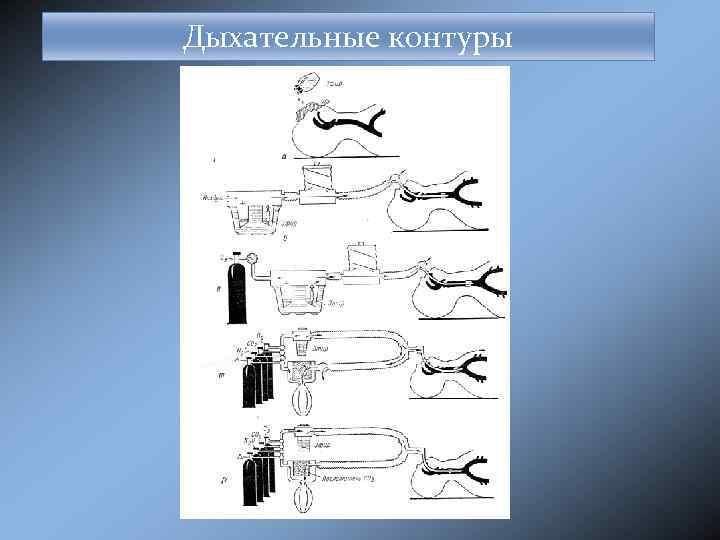 Тип контура. Классификация дыхательных контуров. Дыхательные контуры схема. Контуры в анестезиологии. Открытый контур в анестезиологии.