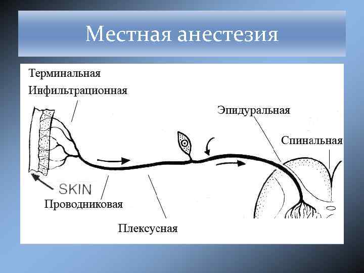 Карта анестезиологического пособия