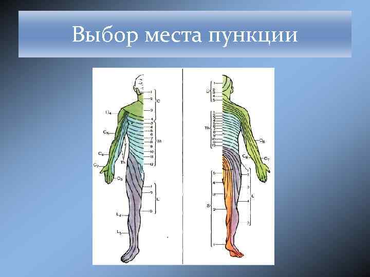 Выбор места пункции 