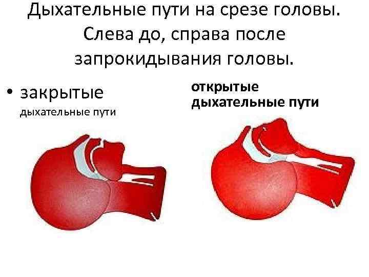 Закрытое дыхание