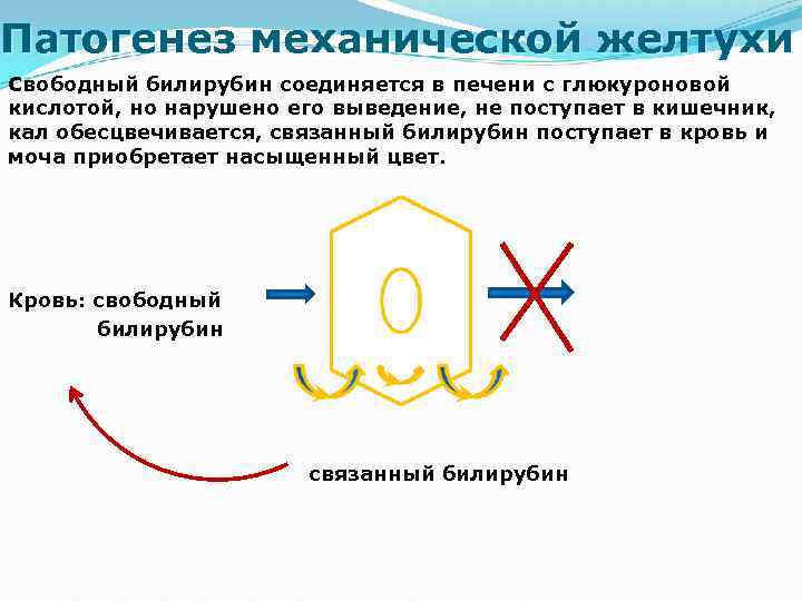 Патогенез механической желтухи схема