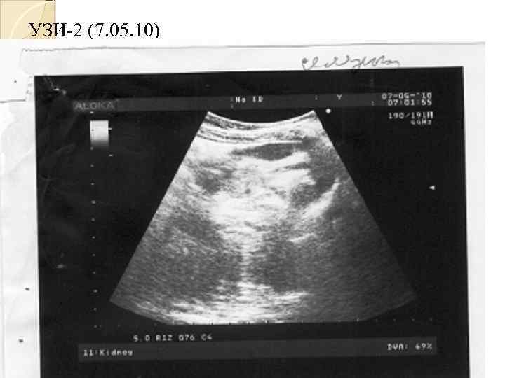 УЗИ-2 (7. 05. 10) 
