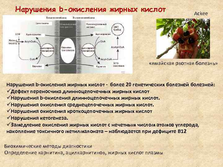 Нарушение окисления жирных кислот