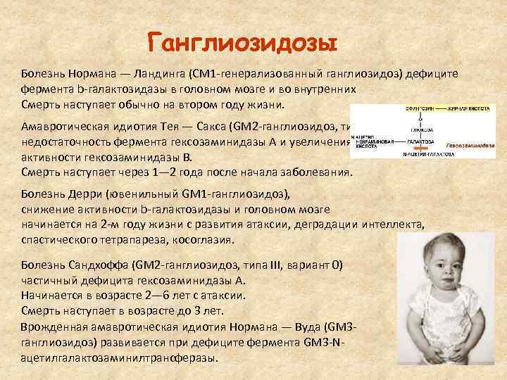 Ганглиозидозы Болезнь Нормана — Ландинга (CM 1 генерализованный ганглиозидоз) дефиците фермента b галактозидазы в