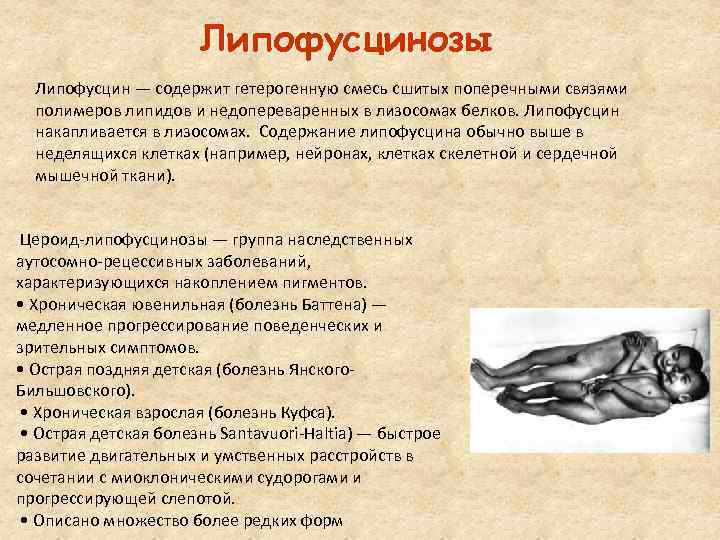Липофусцинозы Липофусцин — содержит гетерогенную смесь сшитых поперечными связями полимеров липидов и недопереваренных в