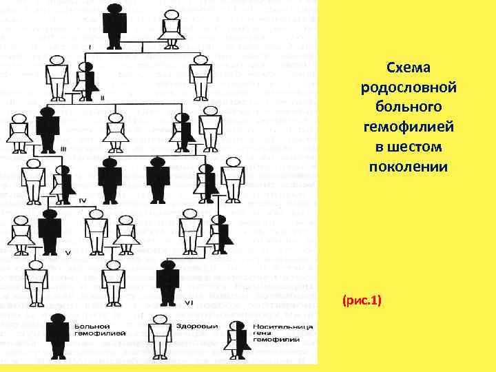 Схема родословной больного гемофилией в шестом поколении (рис. 1) 