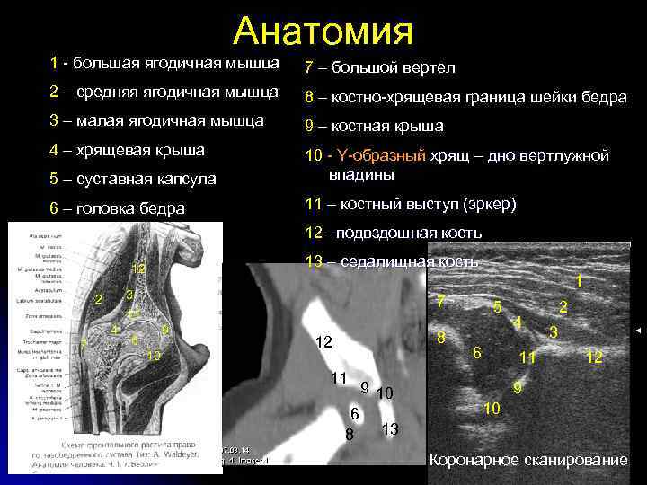 Анатомия 1 - большая ягодичная мышца 7 – большой вертел 2 – средняя ягодичная