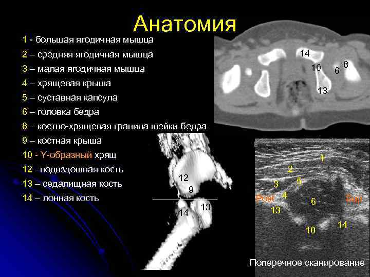Анатомия 1 - большая ягодичная мышца 14 2 – средняя ягодичная мышца 10 3