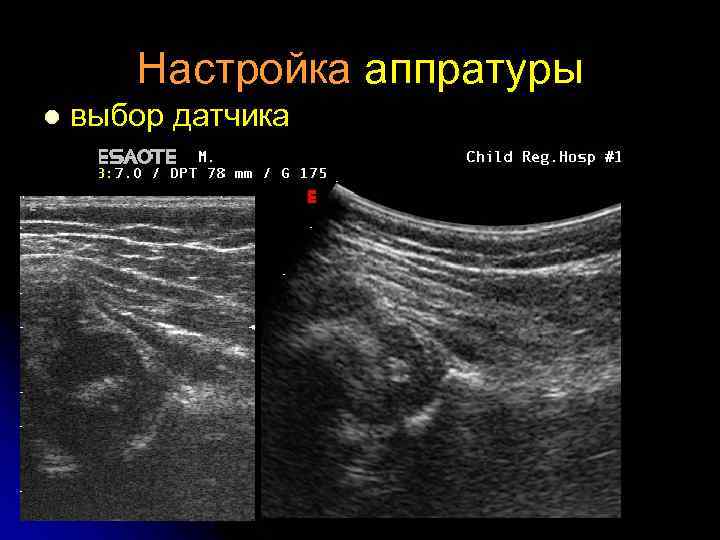 Настройка аппратуры l выбор датчика 