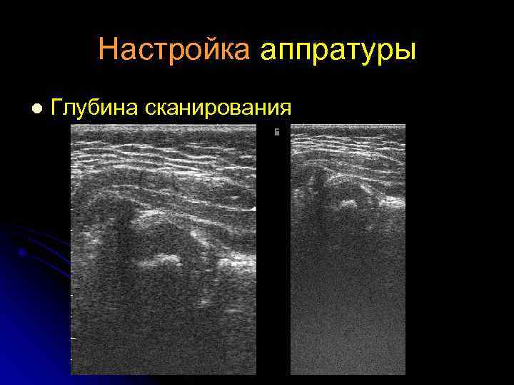 Настройка аппратуры l Глубина сканирования 