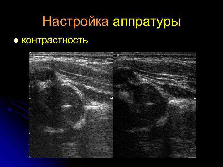 Настройка аппратуры l контрастность 