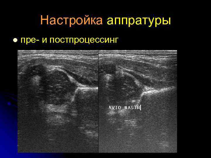 Настройка аппратуры l пре- и постпроцессинг 