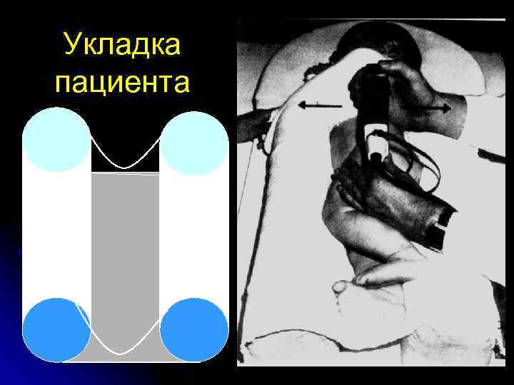 Укладка пациента 