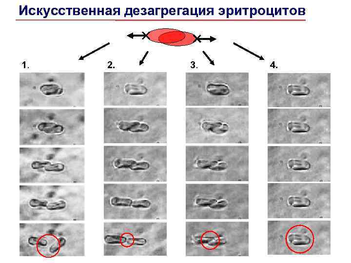 Искусственная дезагрегация эритроцитов 1. 2. 3. 4. 