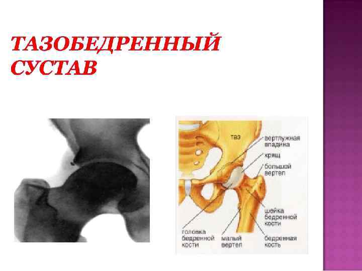 Вертел бедра