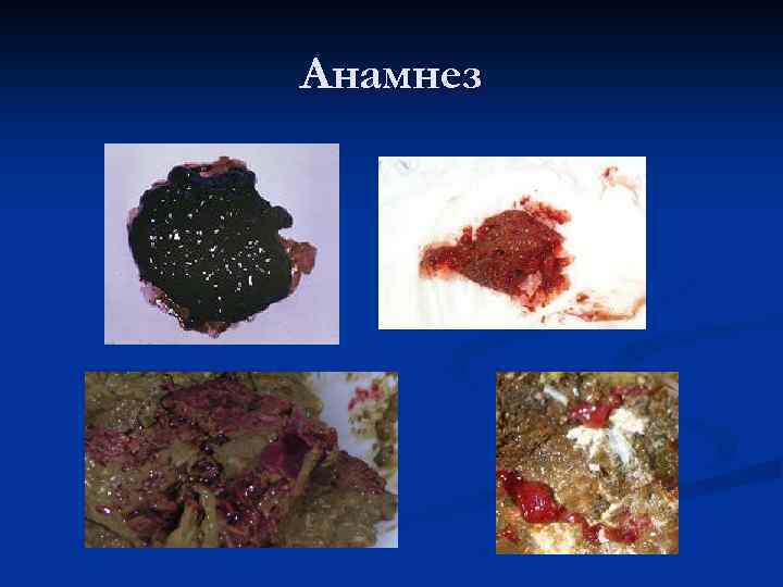 Анамнез 
