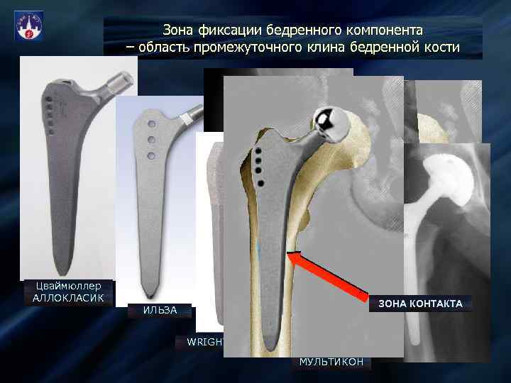 Зона фиксации карта