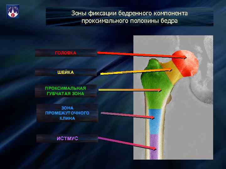 Бедренный отдел. Ростковая зона бедренной кости. Проксимальный отдел бедренной кости. Проксимальная.