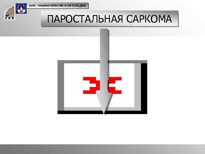 КУРС ТРАВМАТОЛОГИИ И ОРТОПЕДИИ ПАРОСТАЛЬНАЯ САРКОМА 