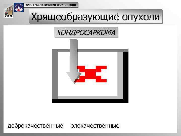 КУРС ТРАВМАТОЛОГИИ И ОРТОПЕДИИ Хрящеобразующие опухоли ХОНДРОСАРКОМА доброкачественные злокачественные 