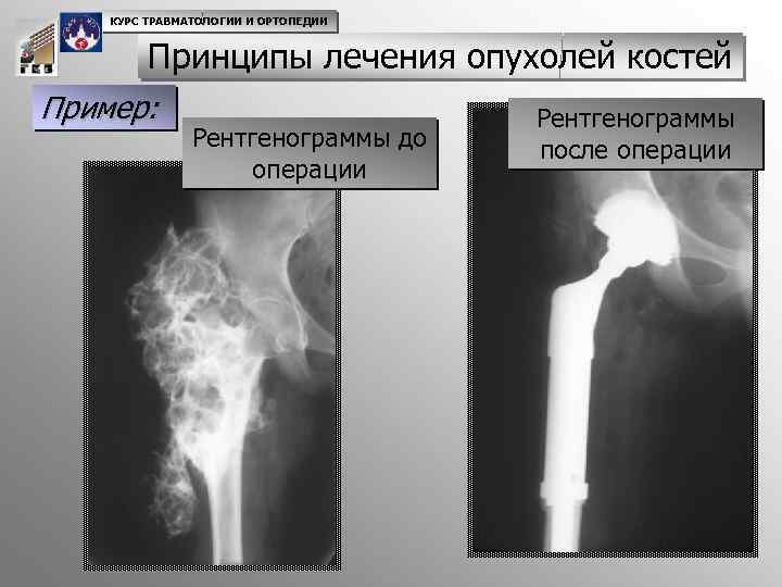 Схема описания рентгенограммы костей