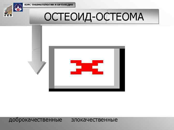 КУРС ТРАВМАТОЛОГИИ И ОРТОПЕДИИ ОСТЕОИД-ОСТЕОМА доброкачественные злокачественные 