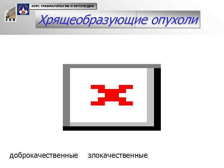 КУРС ТРАВМАТОЛОГИИ И ОРТОПЕДИИ Хрящеобразующие опухоли доброкачественные злокачественные 