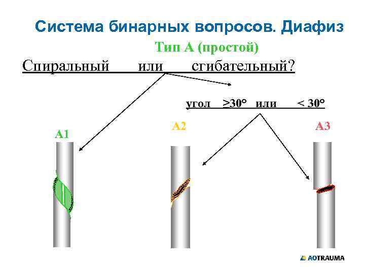 Система бинарных вопросов. Диафиз Тип А (простой) Спиральный или сгибательный? угол А 1 А