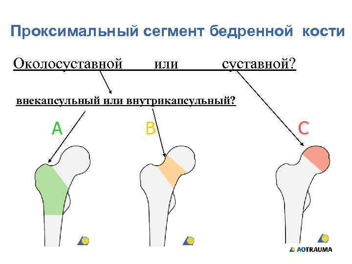 Проксимальный отдел бедренной кости где находится фото