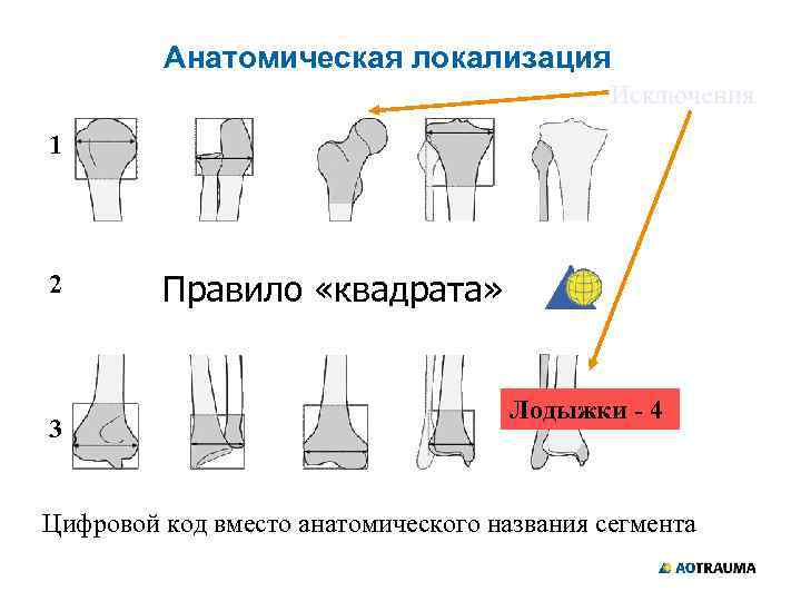 Анатомическая локализация Исключения 1 2 3 Правило «квадрата» Лодыжки - 4 Цифровой код вместо