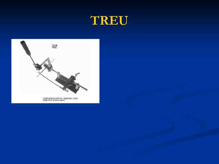 TREU 