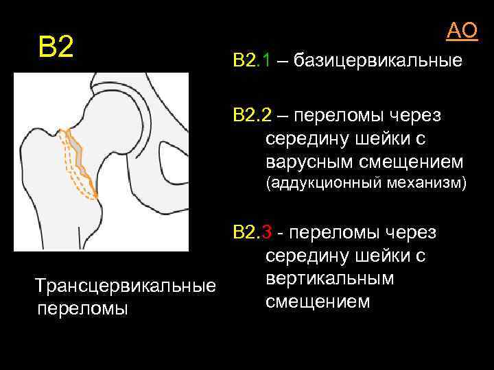 Шейка бедра карта вызова