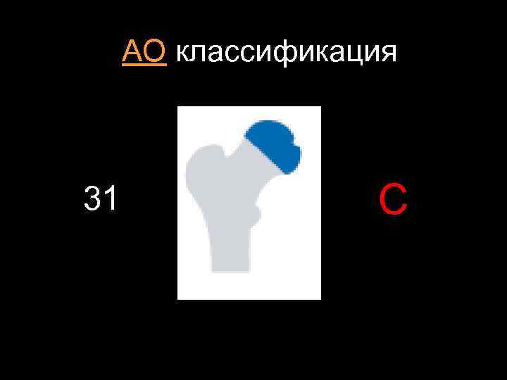 АО классификация 31 C 