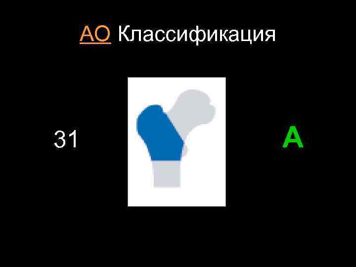 АО Классификация 31 А 