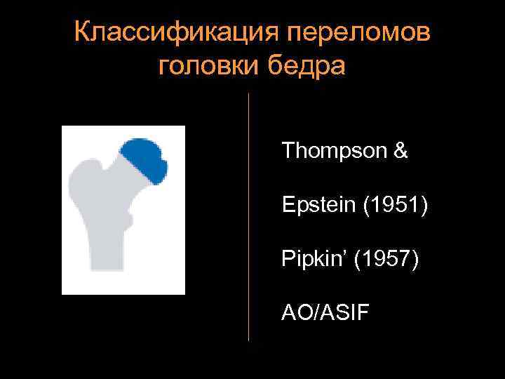 Классификация переломов головки бедра Thompson & Epstein (1951) Pipkin’ (1957) AO/ASIF 